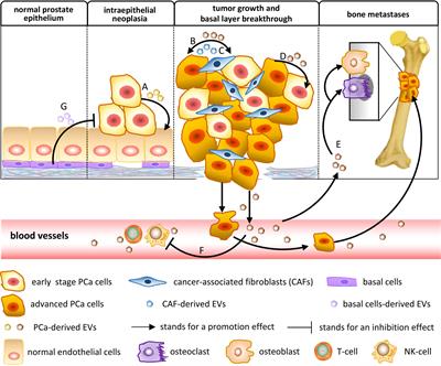 Tumor-derived extracellular vesicle nucleic acids as promising diagnostic biomarkers for prostate cancer